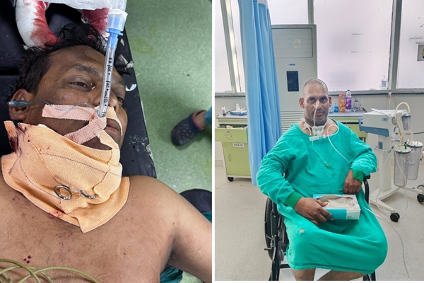 माँझे से कटी आधे से अधिक गर्दन, एम्स ऋषिकेश के चिकित्सकों ने किया सफल ऑपरेशन, दिया नया जीवन