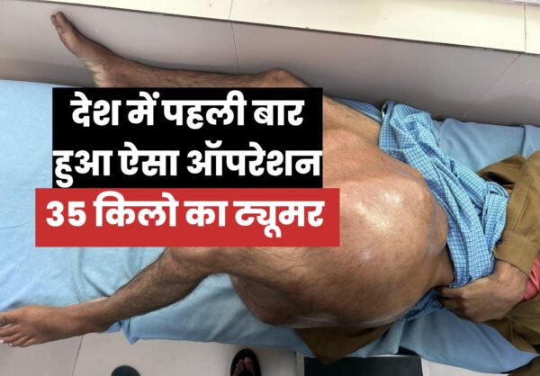 उत्तराखंड : डॉक्टरों ने निकाला 35 किलो का बोन ट्यूमर, देश में अब तक का सबसे बड़ा!