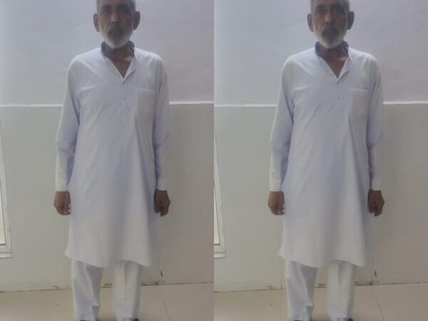 एम्स ऋषिकेश में दिमाग की संकुचित रक्तवाहिनी का कैरोटिड आर्टरी स्टेंटिंग द्वारा सफल प्रत्यारोपण