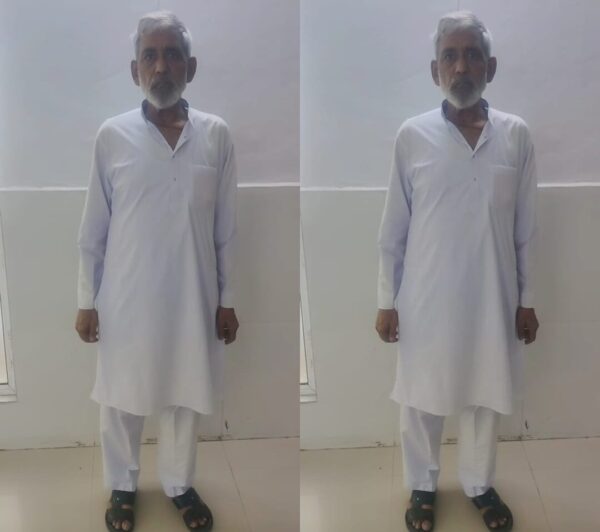 एम्स ऋषिकेश में दिमाग की संकुचित रक्तवाहिनी का कैरोटिड आर्टरी स्टेंटिंग द्वारा सफल प्रत्यारोपण