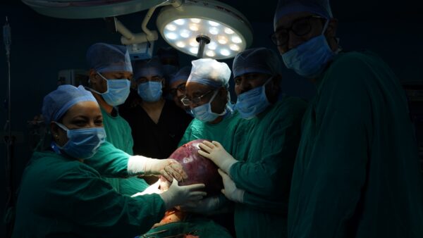 देहरादून के श्री महंत इन्दिरेश अस्पताल में चार घंटे चली जटिल चमत्कारिक सर्जरी – डॉक्टरों ने 20 वर्षीय युवती के पेट से निकाली 13 किलो 200 ग्राम की गांठ, डॉक्टरों की टीम ने रचा नया मेडिकल इतिहास – मरीज को मिला नया जीवन