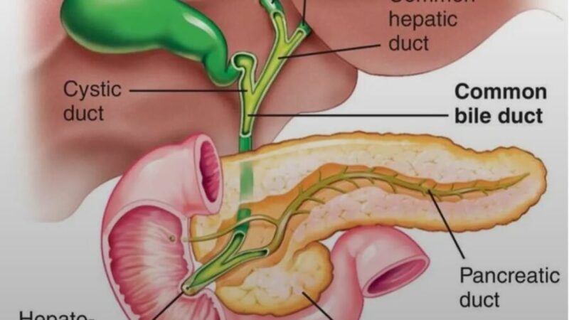 विश्व कैंसर दिवस पर श्री महंत इन्दिरेश अस्पताल ने चिकित्सा जगत में रचा इतिहास, “यूनाइटेड बाय यूनीक” थीम को साकार करती पित्ताशय कैंसर की अति-दुर्लभ सर्जरी, 11 घण्टे तक चली अत्यंत जटिल सर्जरी, 6 अंगों में फैली बीमारी को निकाला गया
